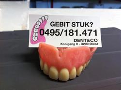 Tandlabo Dent&Co! 30 jaar ervaring !