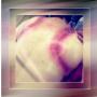 Cupping