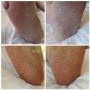 Sofie_Dewitte_Medische_Pedicure