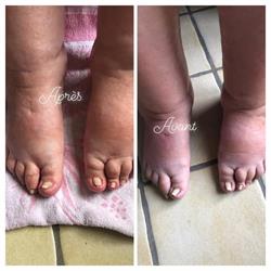 Pedimedi Doris