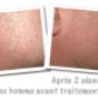 beauté doria épilation visage