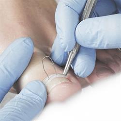 Medische Pedicure Wilrijk