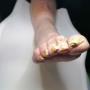 Linkervoet voor behandeling - diabeet