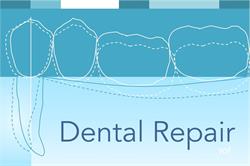Dental Repair vof