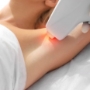 Epilation définitive