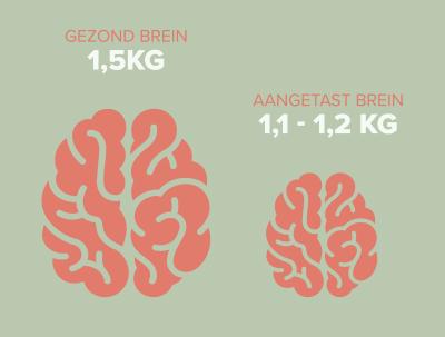 Visual-van-krimpend-brein