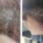Protective braids  - Salon J & C