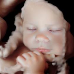 Echo 3D passion - Echographie 3D, 2D, 4D Affective